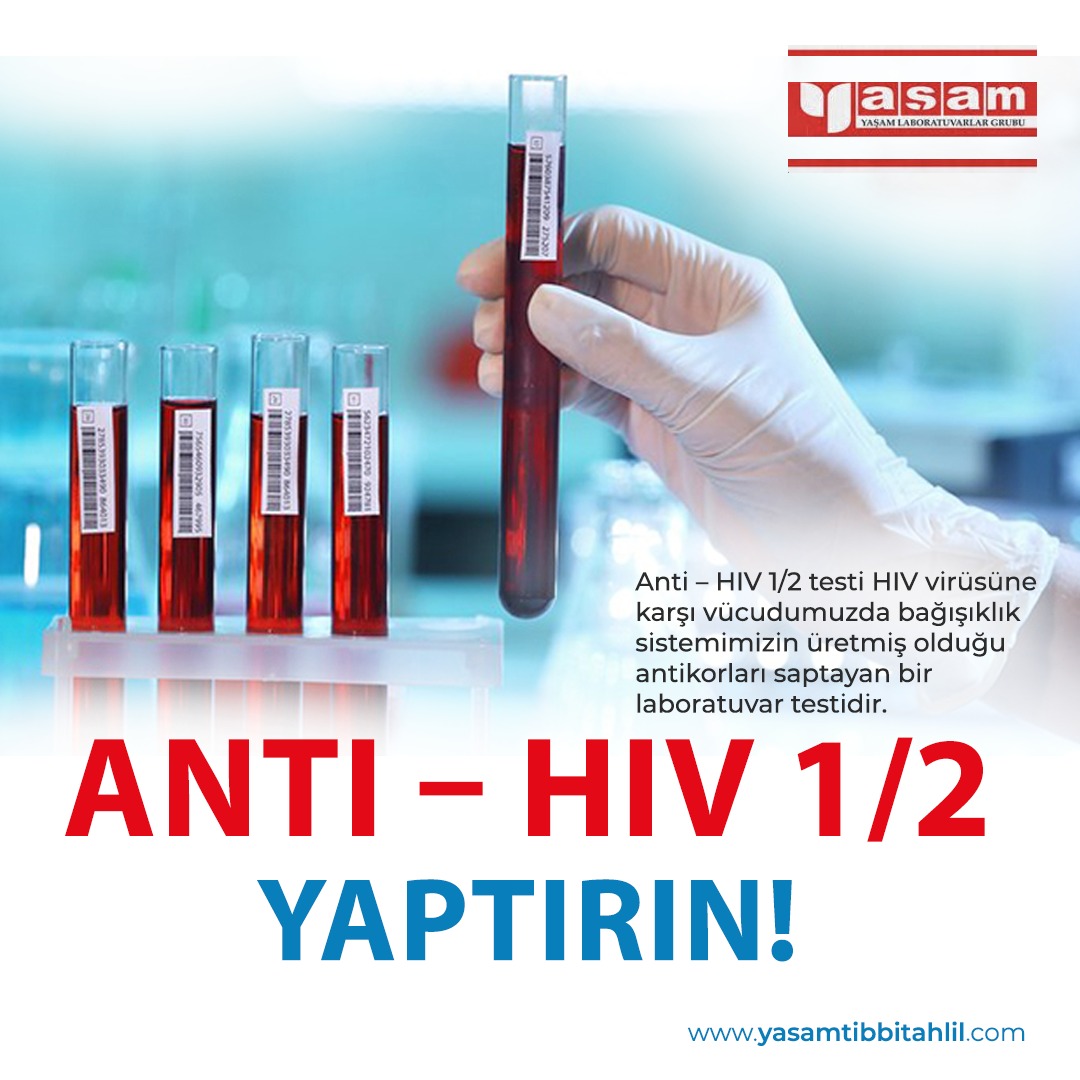 HIV/AIDS Hastalığı Nedir? HIV/AIDS Belirtileri Nelerdir?